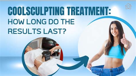 CoolSculpting: How Long Do the Effect.